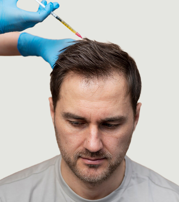Sapphire FUE Hair Transplant at Cara Clinic